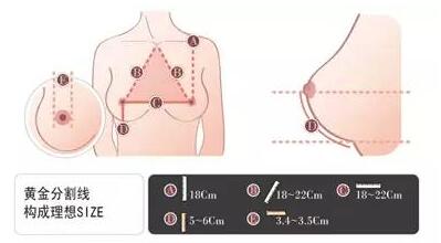 假体隆胸材料哪种好 隆胸假体如何选择