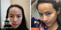 石家庄市第一医院整形科价格表·案例图
